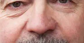 O que o nariz torto revela sobre sua saúde respiratória