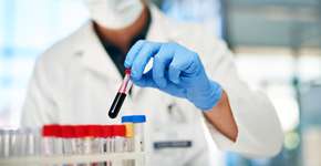 Novo exame pode detectar Alzheimer anos antes dos sintomas