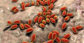 Foto: (katerynakon/DepositPhotos)