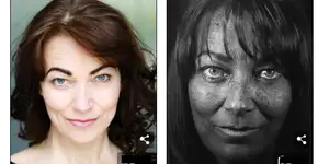 Atriz que venceu câncer faz alerta sobre riscos do bronzeamento