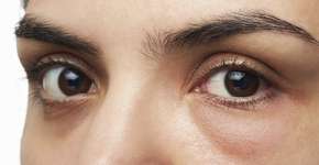 Foto: (Imagem sem texto alternativo disponivel ID [1490990])