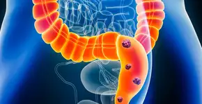 Foto: (iStock/libre de droit)