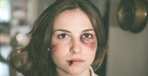 Foto: (Imagem sem texto alternativo disponivel ID [708805])