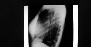 Exposição “Equivocábulos” entra em cartaz no MAB-Centro