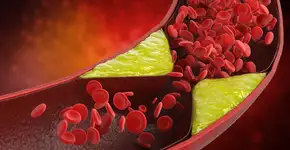 Aliada contra o colesterol e anticâncer: os benefícios da fruta mais consumida do mundo