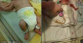 Pais registram em imagens superação de bebê prematuro