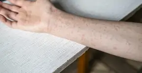 Foto: (Natalya Maisheva/istock)