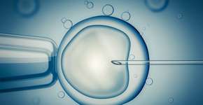 Foto: (vchalup2/DepositPhotos)