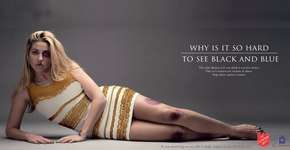 Foto: (Imagem sem texto alternativo disponivel ID [1895146])