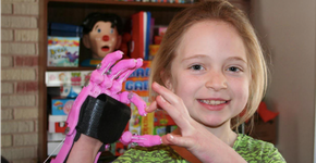 ONG cria rede de voluntários para ajudar a criar próteses em 3D