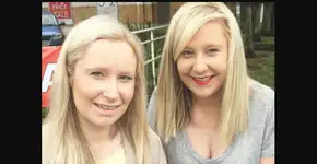 Gêmeas têm condição rara que faz com que músculos virem ossos