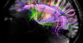 NeuroGames utiliza jogos para mapear cérebro