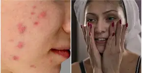 Aprenda como fazer limpeza de pele em casa de maneira segura