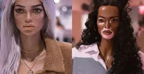 Marca adota manequins com estrias, sardas, pintas e vitiligo