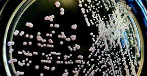 Foto: (Scharvik/istock)