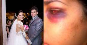 Foto: (Imagem sem texto alternativo disponivel ID [1574289])