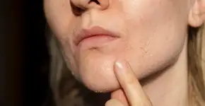 Saiba como manter a pele saudável durante o inverno sem gastar muito