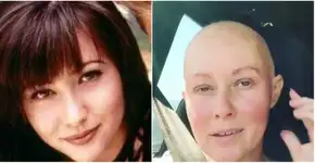 Atriz compartilha rotina na internet após ter câncer de mama