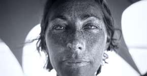 Câmera ultravioleta detecta danos invisíveis do sol na nossa pele