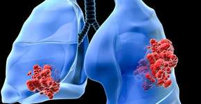 Foto: (Imagem sem texto alternativo disponivel ID [1834985])