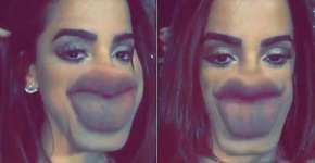 Anitta usa filtro para mostrar ‘preenchimento errado na boca’