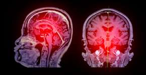 Foto: (mr.suphachai praserdumrongchai/istock)