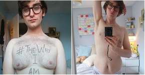 Jovem relata drama por não ter ‘corpo perfeito’ e viraliza na web