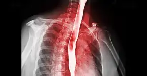 Foto: (mr.suphachai praserdumrongchai/istock)