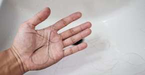 Técnica evita queda de cabelo de pacientes com câncer