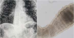 Foto: (reprodução/Twitter/Sinhyu/istock)