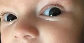 Bebê bravo: conheça o pequeno que está sempre de mau humor