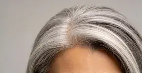 Foto: (Imagem sem texto alternativo disponivel ID [2695071])