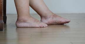 Foto: (Toa55/istock)