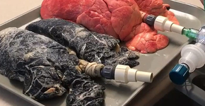 Foto: (Imagem sem texto alternativo disponivel ID [1571311])