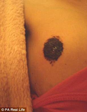 Sam, que acredita que a quimioterapia é tóxica e que afeta as células saudáveis também, começou a fazer pesquisas na internet para procurar tratamentos alternativos (Reprodução/The Daily Mail)