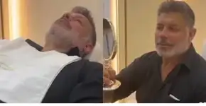 Alexandre Frota mostra antes de depois de harmonização facial