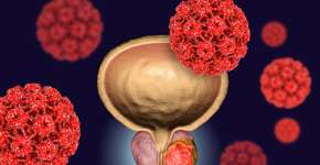 Estudo aponta nutriente que conseguiu reduzir o crescimento de tumor de próstata
