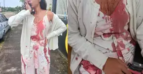 O que se sabe sobre o caso da jovem que teve o rosto cortado em ônibus na BA