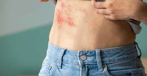 Clima favorece avanço de doença preocupante no Brasil