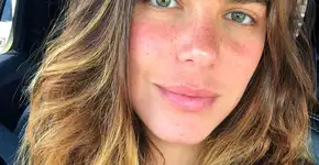 Mariana Goldfarb mostra bumbum com estrias e dá lição de autoestima