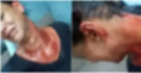 Defensoria Pública de SP recebe denúncias de agressões