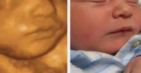 Fotos de bebês antes e depois do nascimento são a coisa mais fofa