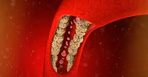 Foto: (iStock/vampy1)