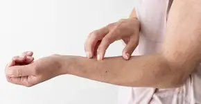 Coceira inexplicável pode indicar problemas de saúde