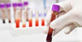 Foto: (kukhunthod/istock)