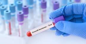 Hormônio do crescimento pode ajudar no tratamento da ansiedade, revela estudo da USP