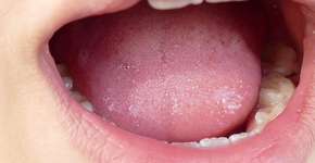 Foto: (iStock/nzfhatipoglu)