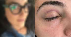 Mulher relata agressão de seguranças de casa noturna em São Paulo