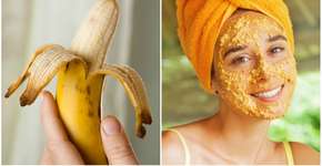 Como tirar acne, rugas e manchas? A casca da banana pode ajudar