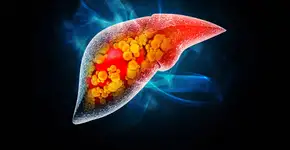 O que comer no café da manhã para combater a gordura no fígado